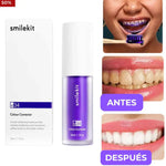 Blanqueamiento Dental Seguro y Efectivo + ¡Resultados Visibles sin Dañar tu Esmalte!