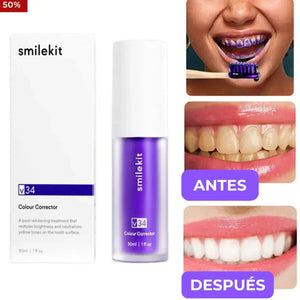 Blanqueamiento Dental Seguro y Efectivo + ¡Resultados Visibles sin Dañar tu Esmalte!